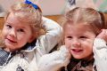 Pioneering treatment saves identical twins from rare pregnancy condition