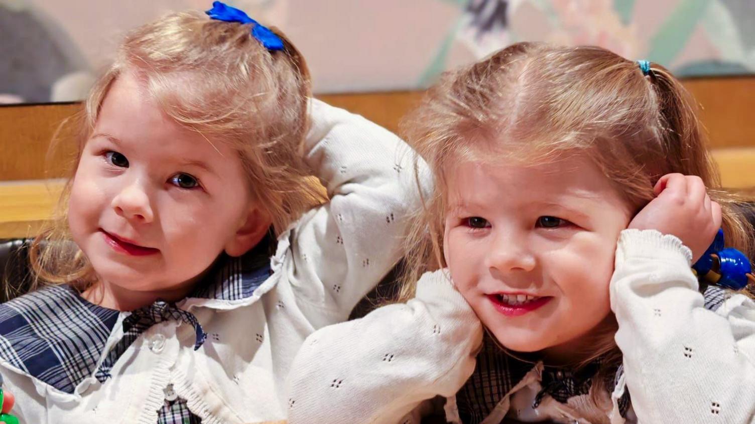 Pioneering treatment saves identical twins from rare pregnancy condition